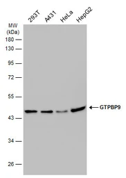 Anti-GTPBP9 antibody [C1C3] used in Western Blot (WB). GTX118605