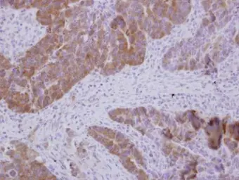 Anti-GTPBP9 antibody [C1C3] used in IHC (Paraffin sections) (IHC-P). GTX118605