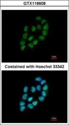 Anti-MINA53 antibody [N2C3] used in Immunocytochemistry/ Immunofluorescence (ICC/IF). GTX118608