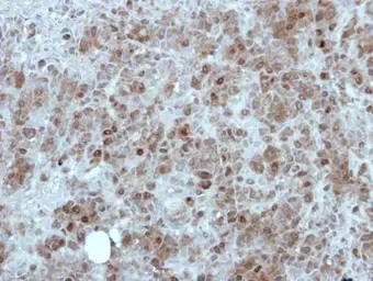 Anti-MINA53 antibody [N2C3] used in IHC (Paraffin sections) (IHC-P). GTX118608