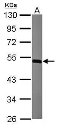 Anti-MINA53 antibody [N2C3] used in Western Blot (WB). GTX118608