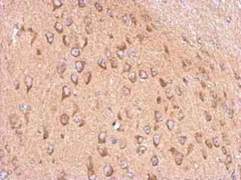 Anti-Membralin antibody used in IHC (Paraffin sections) (IHC-P). GTX118618