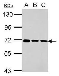 Anti-Membralin antibody used in Western Blot (WB). GTX118618