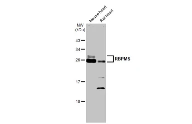 Anti-RBPMS antibody used in Western Blot (WB). GTX118619