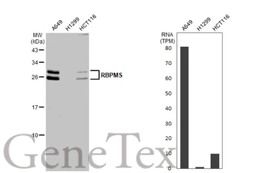 Anti-RBPMS antibody used in Western Blot (WB). GTX118619