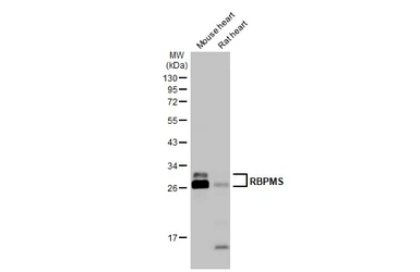 Anti-RBPMS antibody used in Western Blot (WB). GTX118619