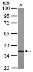 Anti-CFHL1 antibody [N1C2] used in Western Blot (WB). GTX118620