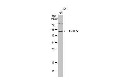 Anti-TRIM72 antibody used in Western Blot (WB). GTX118625