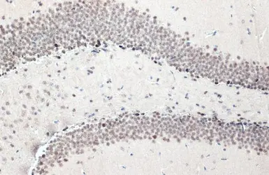 Anti-NFIX antibody [N2C2], Internal used in IHC (Paraffin sections) (IHC-P). GTX118630