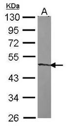 Anti-ZNF239 antibody [N2C3-2] used in Western Blot (WB). GTX118632