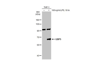 Anti-GBP5 antibody [N3C3] used in Western Blot (WB). GTX118635