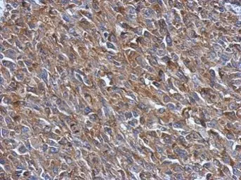 Anti-PRPSAP2 antibody [N2C3] used in IHC (Paraffin sections) (IHC-P). GTX118643