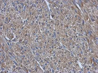 Anti-PRPSAP2 antibody [N2C3] used in IHC (Paraffin sections) (IHC-P). GTX118643