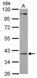 Anti-PRPSAP2 antibody [N2C3] used in Western Blot (WB). GTX118643