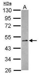 Anti-RBM41 antibody [N3C3] used in Western Blot (WB). GTX118659