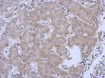 Anti-MRPL10 antibody [N2C3] used in IHC (Paraffin sections) (IHC-P). GTX118663