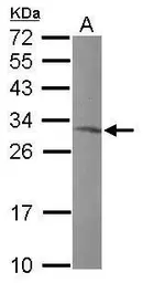 Anti-MRPL10 antibody [N2C3] used in Western Blot (WB). GTX118663