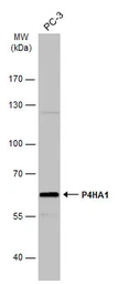 Anti-P4HA1 antibody [C1C3] used in Western Blot (WB). GTX118673