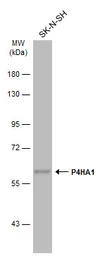 Anti-P4HA1 antibody [C1C3] used in Western Blot (WB). GTX118673