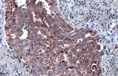 Anti-P4HA1 antibody [C1C3] used in IHC (Paraffin sections) (IHC-P). GTX118673