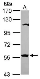 Anti-OASL antibody [N3C3] used in Western Blot (WB). GTX118680