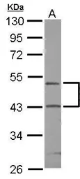 Anti-RPIP8 antibody [N1C1] used in Western Blot (WB). GTX118684
