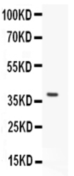 Anti-Stra8 antibody used in Western Blot (WB). GTX11870