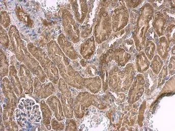 Anti-p53 antibody [C2C3], C-term used in IHC (Paraffin sections) (IHC-P). GTX118730