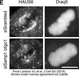 Anti-HAUS6 antibody used in Immunocytochemistry/ Immunofluorescence (ICC/IF). GTX118732