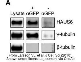 Anti-HAUS6 antibody used in Western Blot (WB). GTX118732