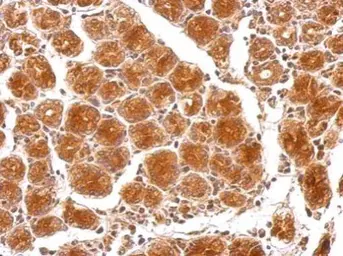 Anti-HAUS6 antibody used in IHC (Paraffin sections) (IHC-P). GTX118732