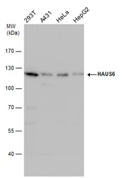 Anti-HAUS6 antibody used in Western Blot (WB). GTX118732