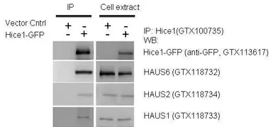 Anti-HAUS6 antibody used in Western Blot (WB). GTX118732