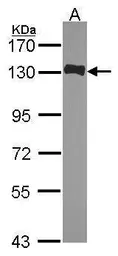 Anti-HAUS6 antibody used in Western Blot (WB). GTX118732