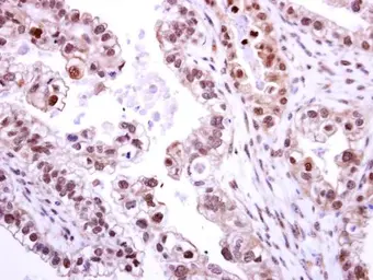 Anti-NEK2 antibody used in IHC (Paraffin sections) (IHC-P). GTX118735