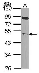 Anti-NEK2 antibody used in Western Blot (WB). GTX118735