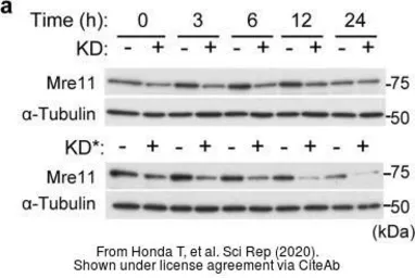 Anti-Mre11 antibody used in Western Blot (WB). GTX118741