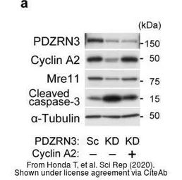 Anti-Mre11 antibody used in Western Blot (WB). GTX118741