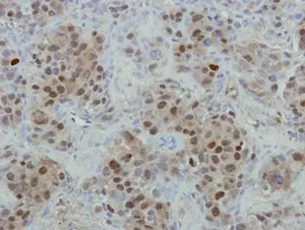 Anti-Mre11 antibody used in IHC (Paraffin sections) (IHC-P). GTX118741