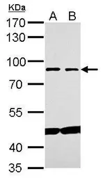 Anti-Mre11 antibody used in Western Blot (WB). GTX118741