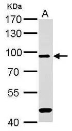 Anti-Mre11 antibody used in Western Blot (WB). GTX118741