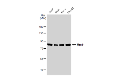 Anti-Mre11 antibody used in Western Blot (WB). GTX118741
