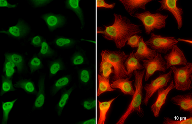Anti-Mre11 antibody used in Immunocytochemistry/ Immunofluorescence (ICC/IF). GTX118741