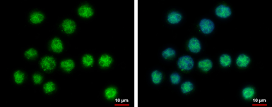 Anti-SERTAD2 antibody used in Immunocytochemistry/ Immunofluorescence (ICC/IF). GTX118746