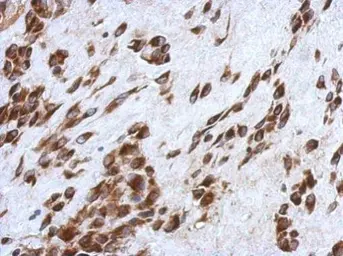 Anti-CCDC44 antibody used in IHC (Paraffin sections) (IHC-P). GTX118757