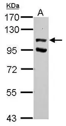 Anti-USP37 antibody used in Western Blot (WB). GTX118769