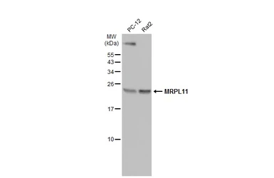Anti-MRPL11 antibody [N1C3] used in Western Blot (WB). GTX118773