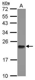 Anti-MRPL11 antibody [N1C3] used in Western Blot (WB). GTX118773