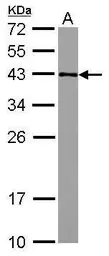 Anti-GFOD2 antibody [C1C3] used in Western Blot (WB). GTX118777