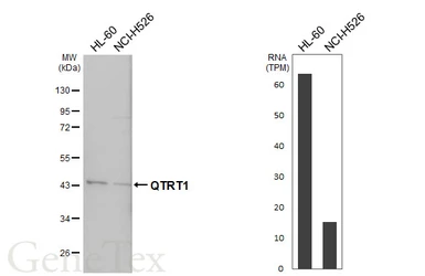 Anti-QTRT1 antibody used in Western Blot (WB). GTX118778